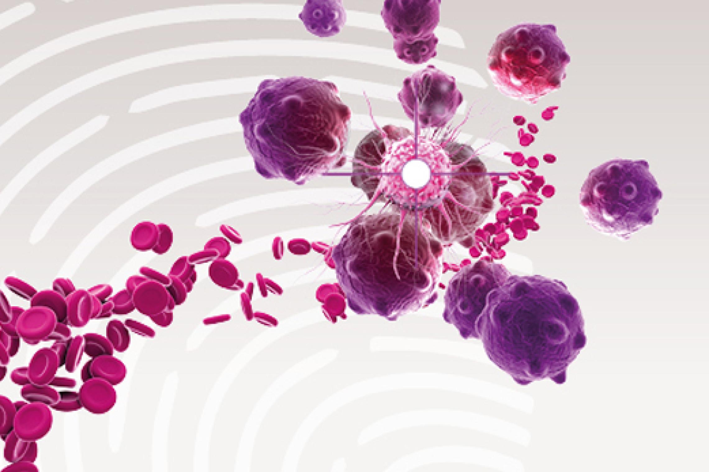 Nierenzellkarzinom Stadien BMSOnkologie