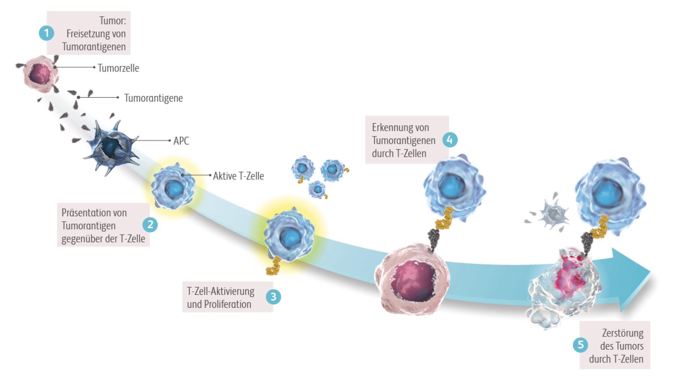 Mit Hilfe von B- und T-Zellen kann das Immunsystem Krebszellen erkennen und zerstören. Tumorzellen tragen Antigene, die eine Immunantwort auslösen. Immunzellen erkennen diese Antigene als körperfremd und greifen die Tumorzelle an.