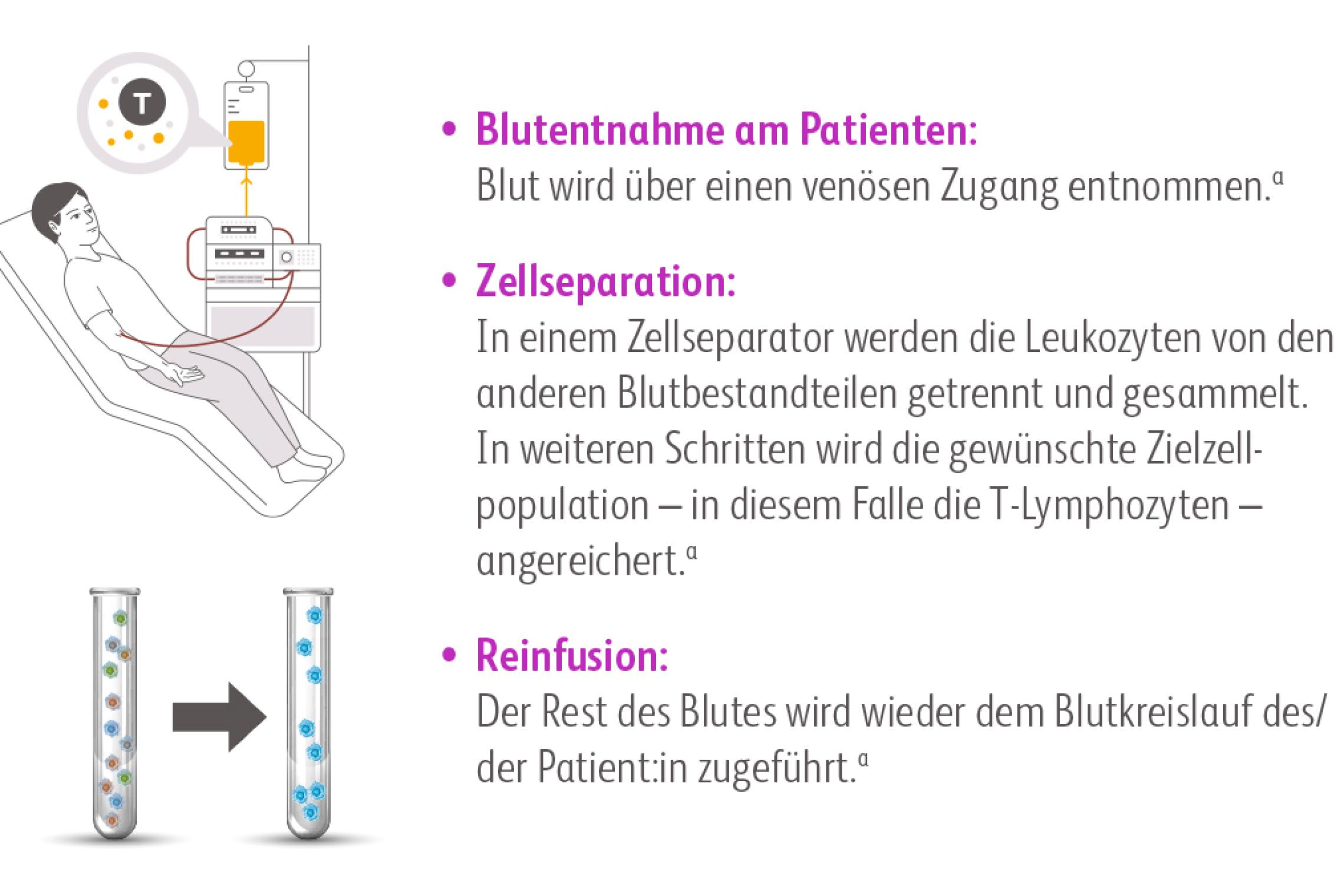 Bei der Leukapherese werden die Leukozyten aus dem Blut des/der Patient:in von den restlichen Blutbestandteilen separiert. Der Rest des Blutes wird reinfundiert.