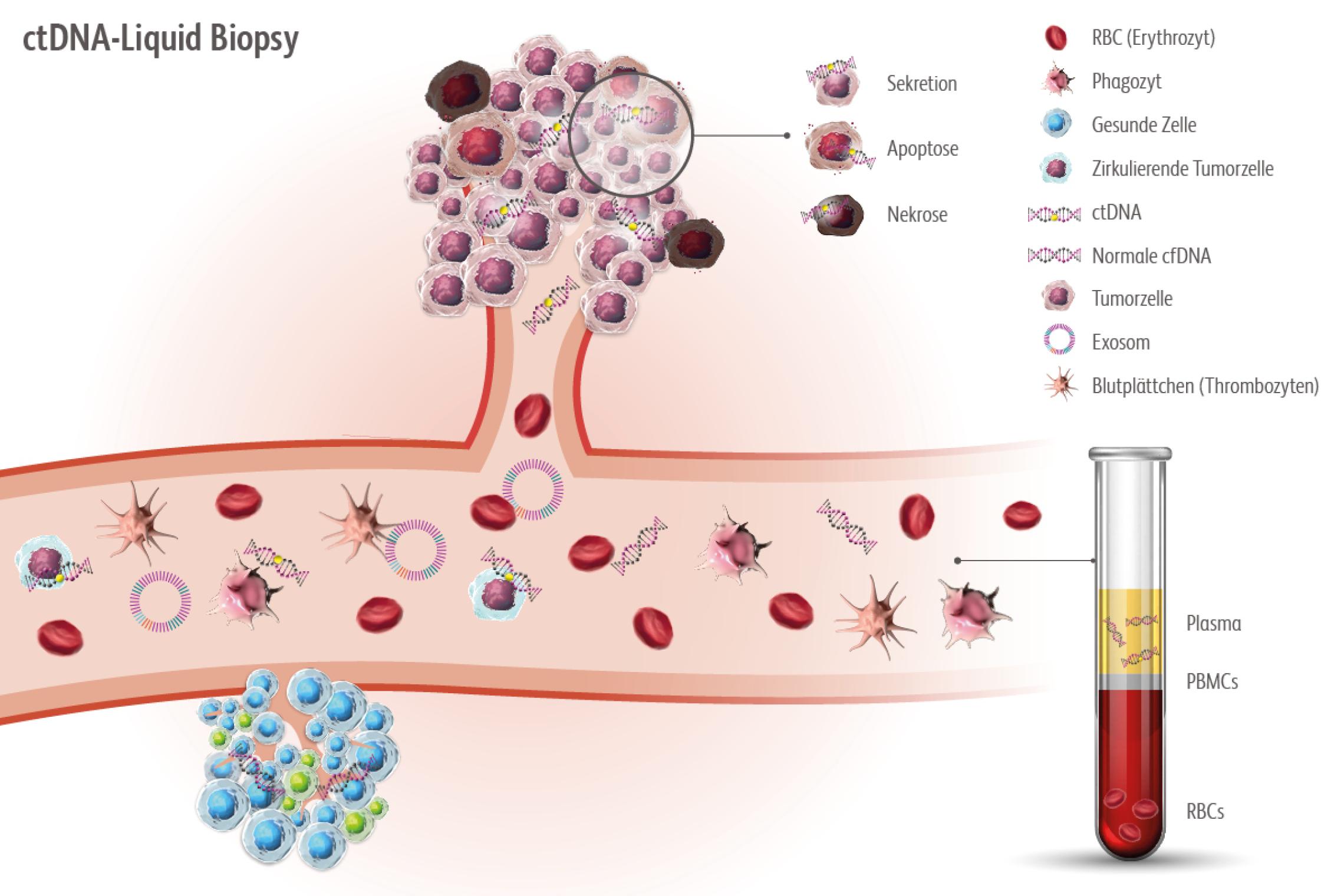 ctDNA stammen von malignen Tumoren oder zirkulierenden Tumorzellen ab und sind in Körperflüssigkeiten wie z. B. im Blut und Urin nachweisbar.