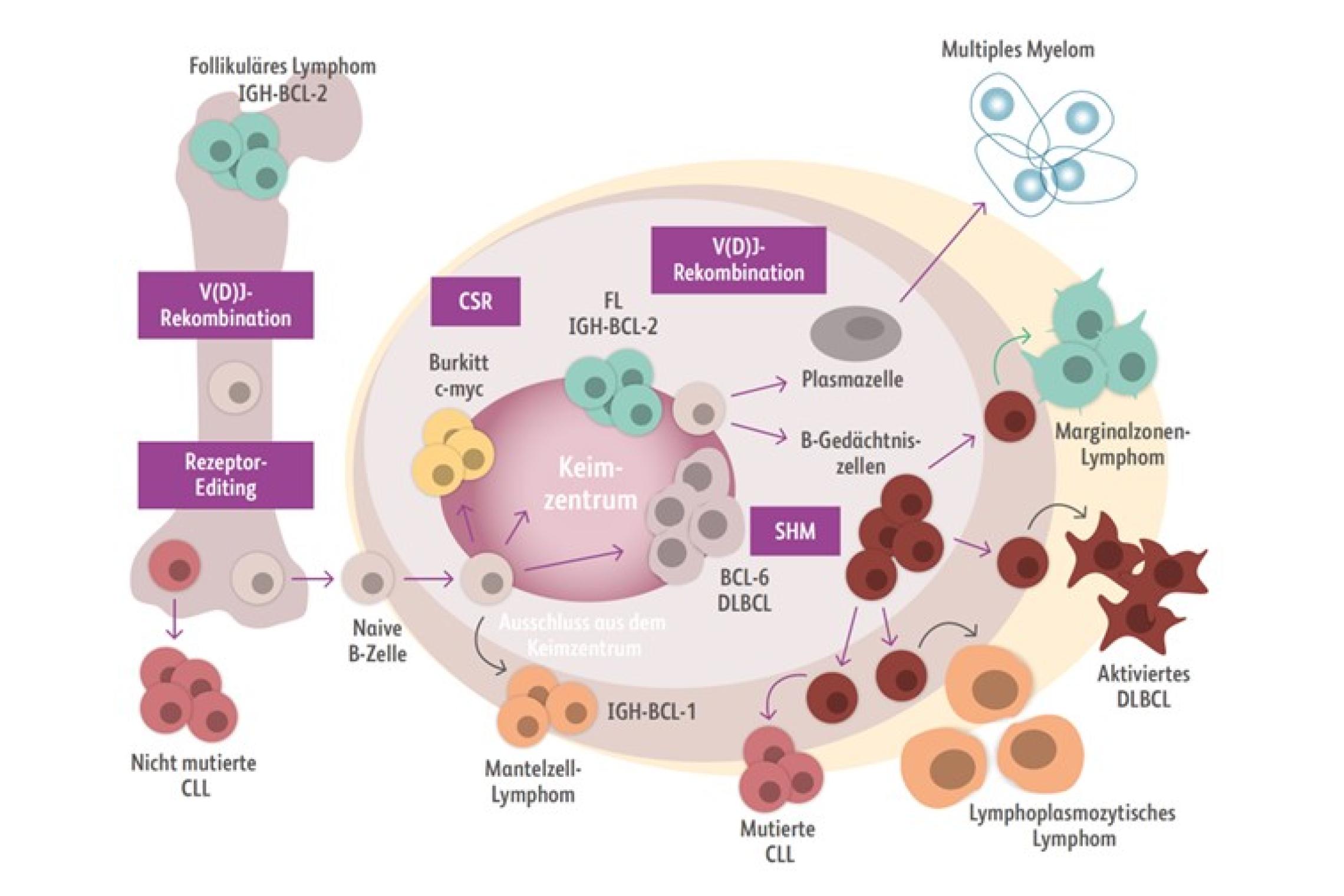 DLBCL Therapie BMSOnkologie